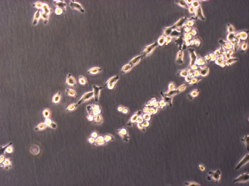 HeLa Zellen auf inhomogenem Plastik extrem