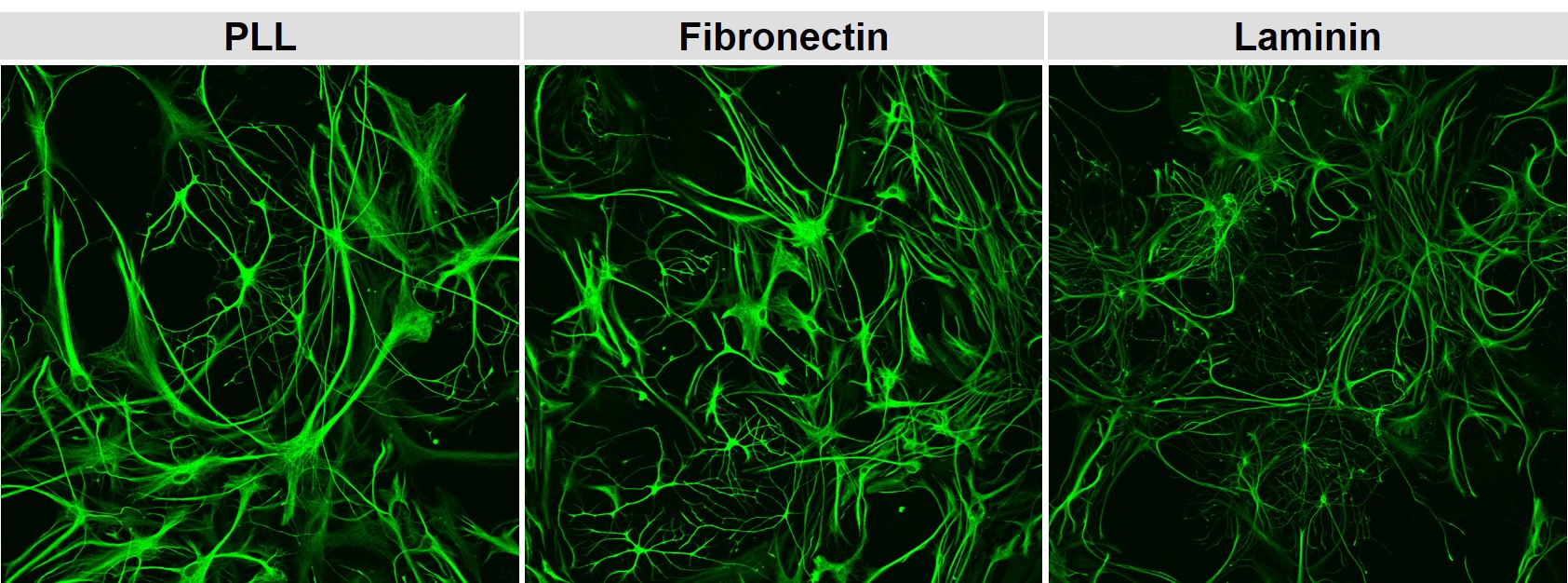 Ratten-Astrozyten auf PLL, Fibronektin und Laminin