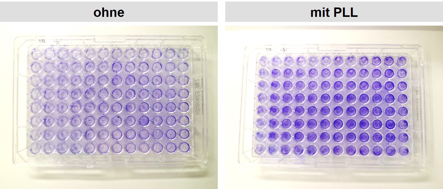 HEK Zellen mit und ohne PLL coating auf Greiner Plastik