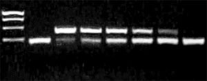 Mykoplasmen PCR Gel