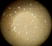 Neubauerkammer Eckquadrat im Mikroskop