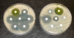 Multi-resistente Bakterien